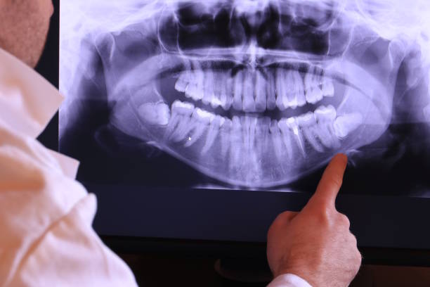 Best Emergency Root Canal Therapy in New Paris, IN