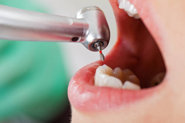 Best Emergency Pediatric Dental Care in New Paris, IN